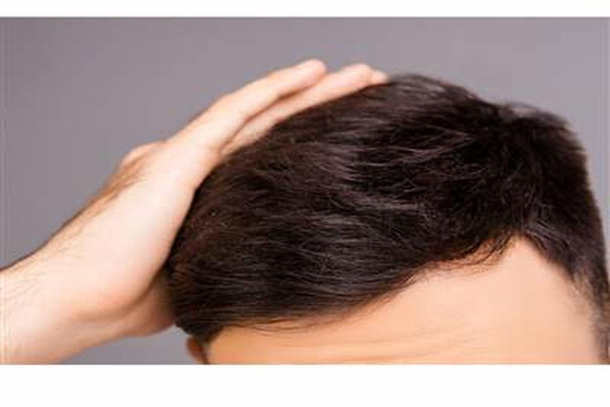 ترفند افزایش رشد مو | بیوتین مصرف کن تا موهات نریزه